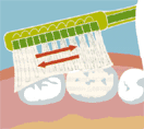 Методика чистки зубов 4